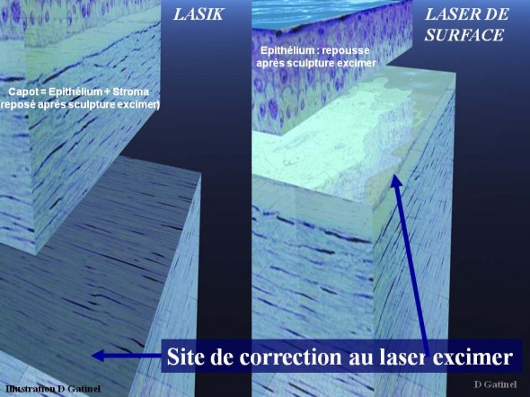 Site découpe