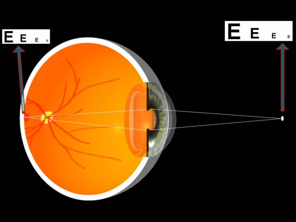 Oeil non presbyte