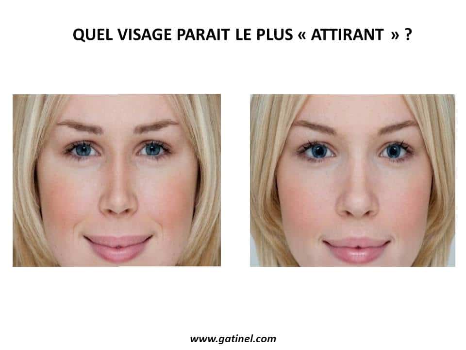 comment avoir les pupilles dilatees