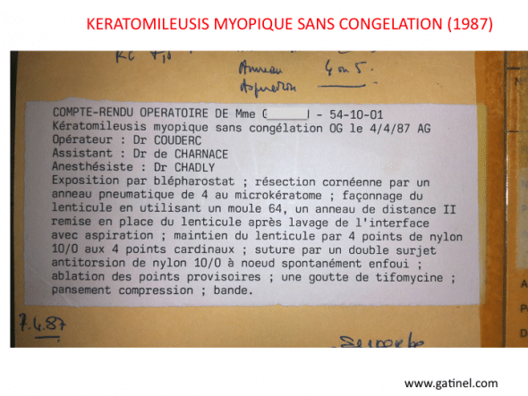 Compte rendu d'une intervention de Keratomileusis myopique sans congélation, effectuée par le Dr Couderc à la Fondation Rothschild en 1987.