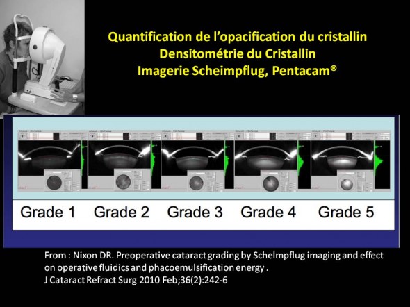 Densitométrie du cristallin