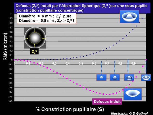 aberration sphérique défocus