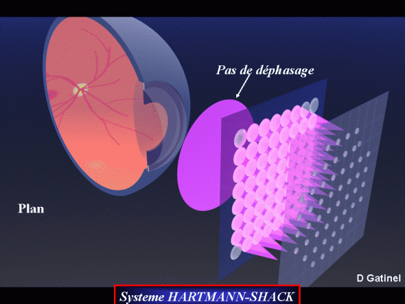 Aberrométrie pas de déphasage