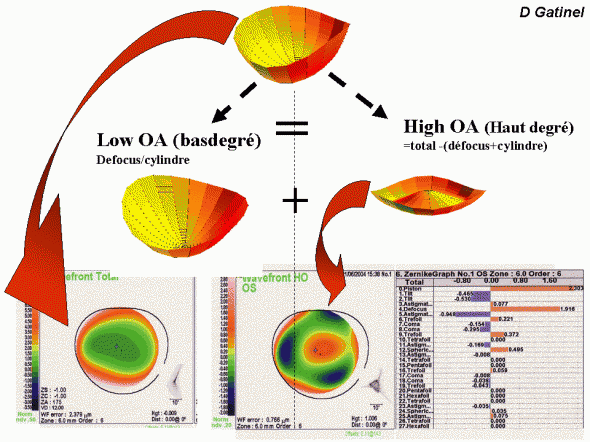 Carte Aberrometrie haut et bas degré