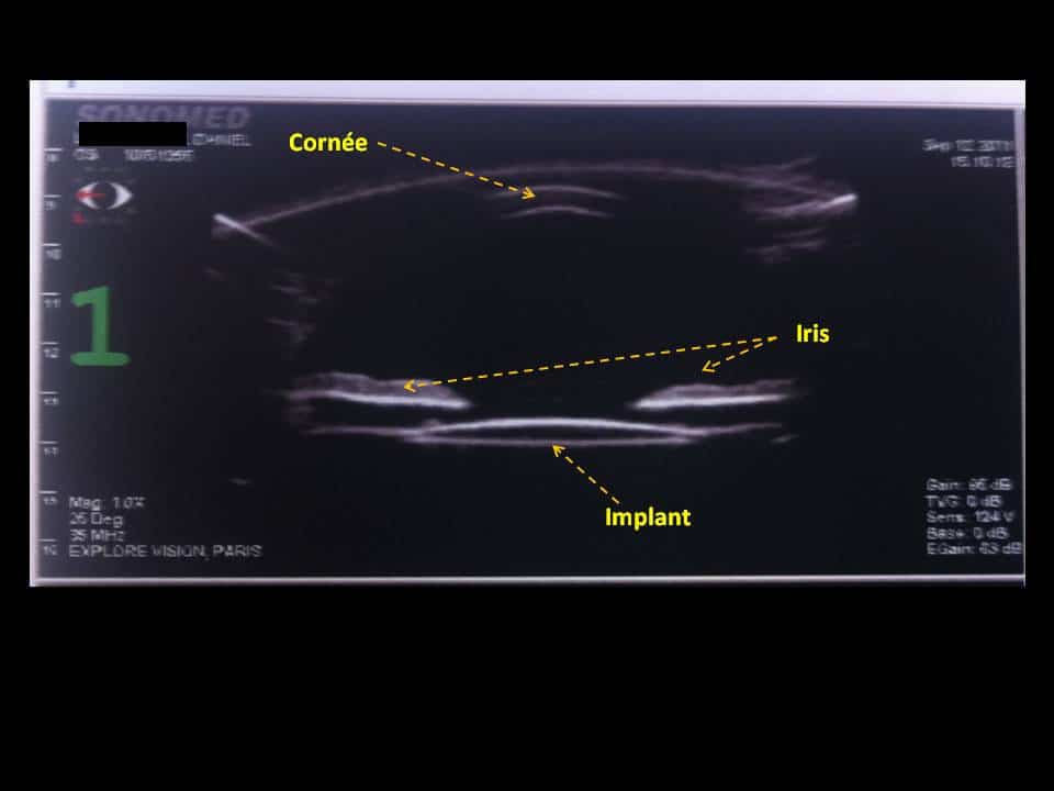 Echographie : principe, indication, déroulé, coût