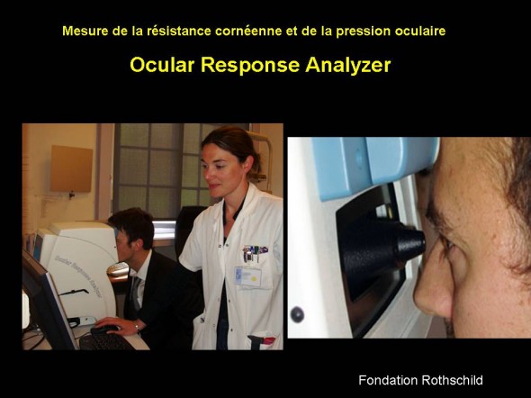 Ocular Response Analyzer