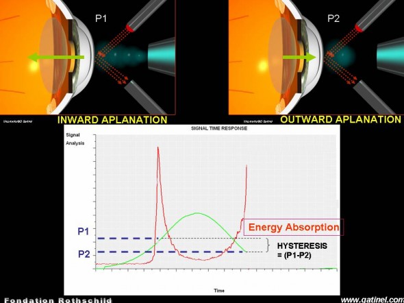 Ocular Response Analyzer Diagramme