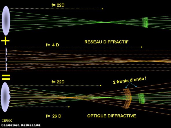 reseau diffractif implant