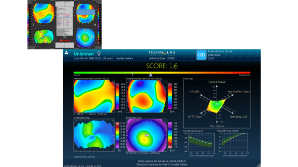 score analyzer