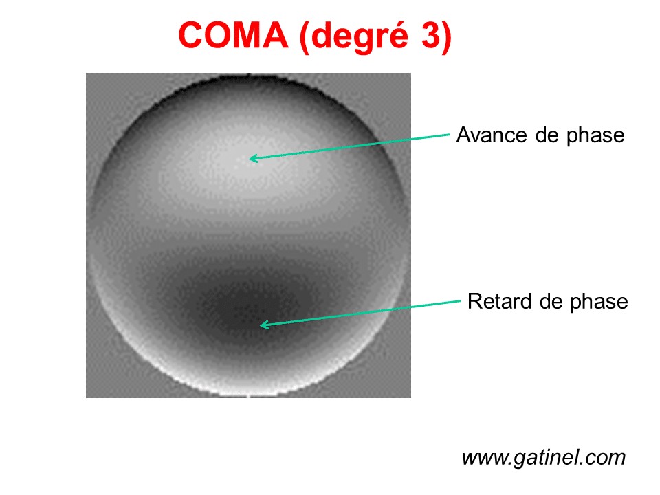 Aberrométrie, front d'onde: principes généraux - Docteur Damien Gatinel