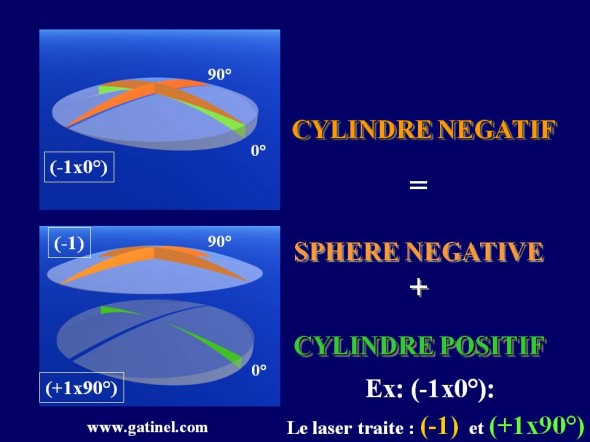 formule cylindre negatif cylindre positif relation correction laser