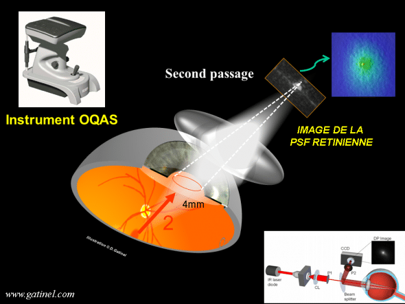 mesure dela diffusion optique avec l'instrument OQAS double passage