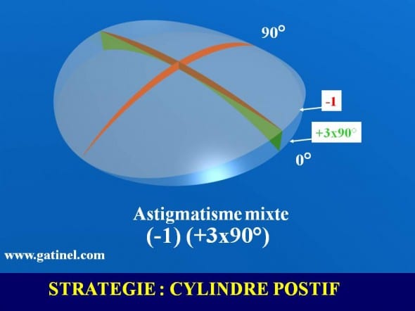 lenticule astigmatisme mixte profil d'ablation