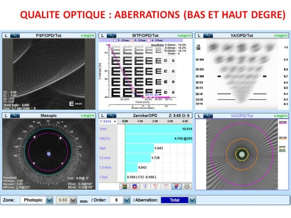 Keratocone qualite optique convolution MTF