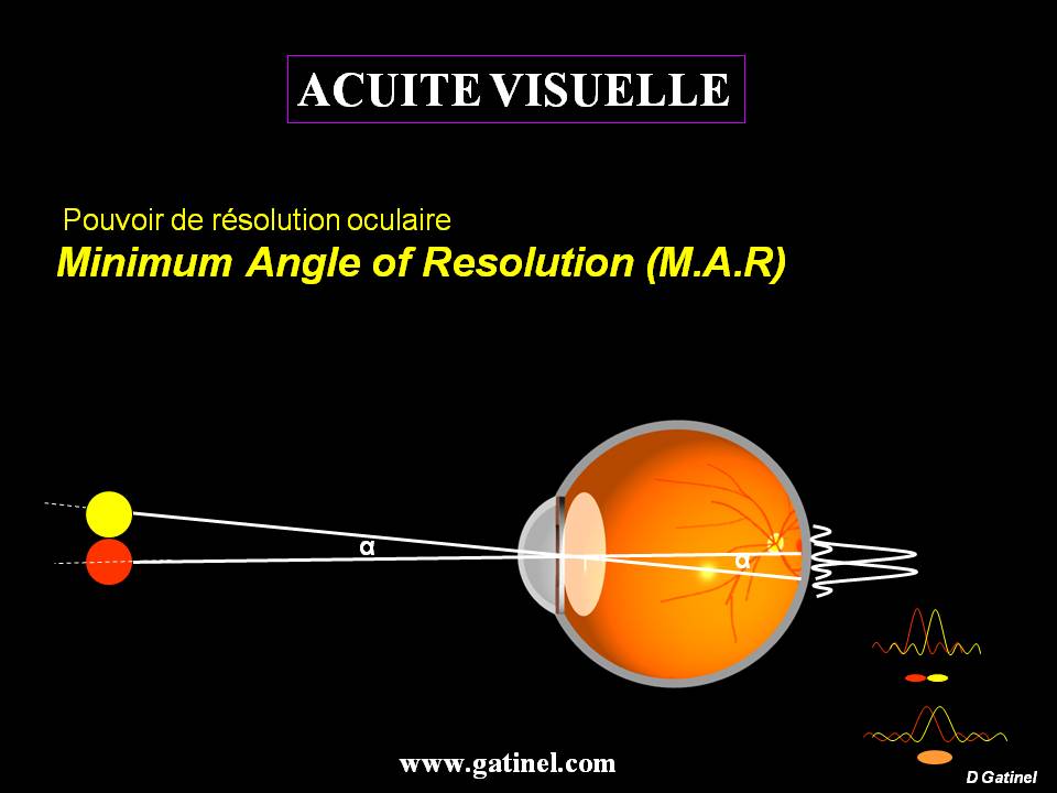 Réflexion sur miroirs courbes sphériques - Docteur Damien Gatinel