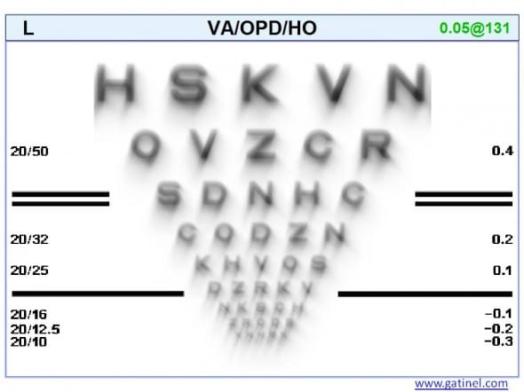 optotypes convolution coma