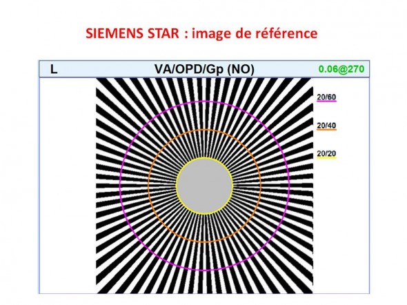 siemens star etoile