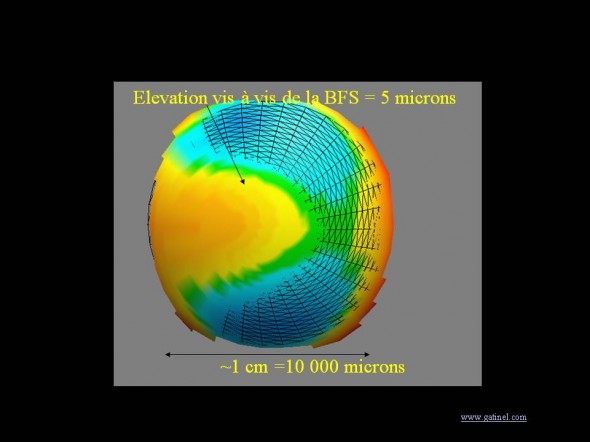 topographie cornéenne elevation microns 3D
