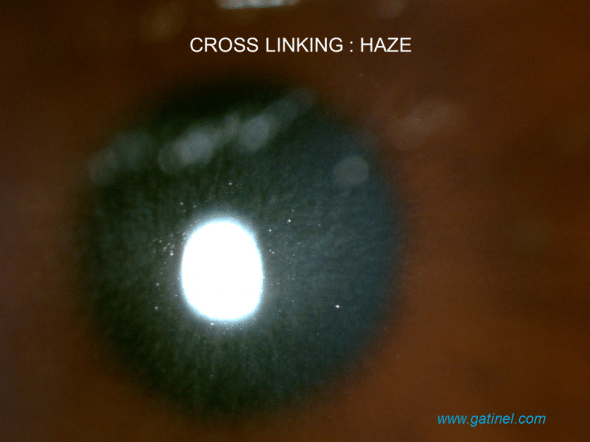 haze post cross linking