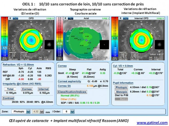 carte Nidek OPD III implant réfracfif