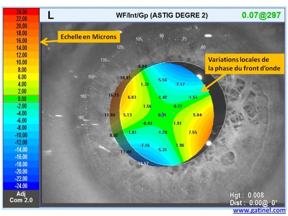 déphasage astigmatisme cornéen OPD