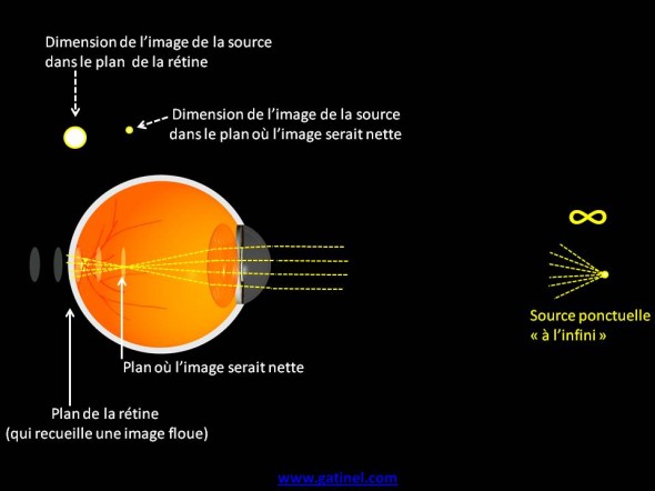 myopie image floue