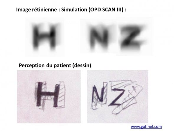 Copies doubles difficultés visuelles