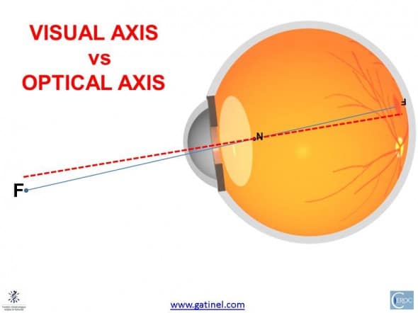 optical axis vs visual axis eye