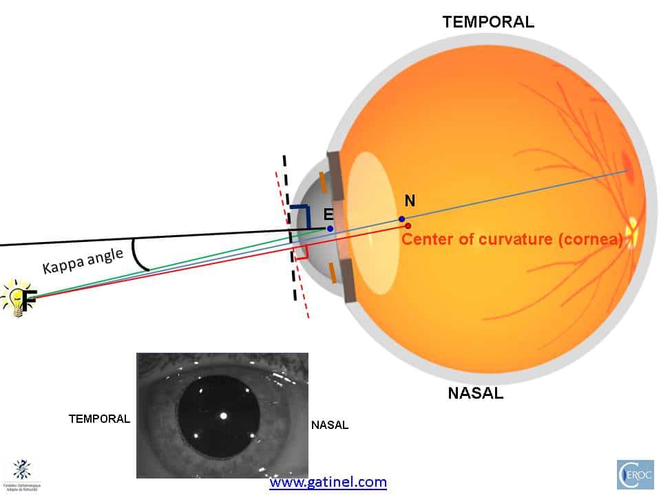 circulatie Australische persoon Inzet Pupillary axis, kappa angle - Docteur Damien Gatinel