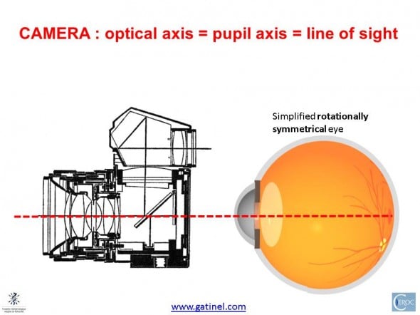 symmetrical eye , optical axis