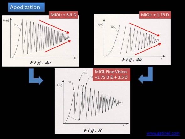 apodization of the trifocal profile of the trifocal IOL