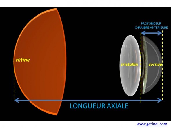 biométrie oculaire, longueur axiale kératométrie