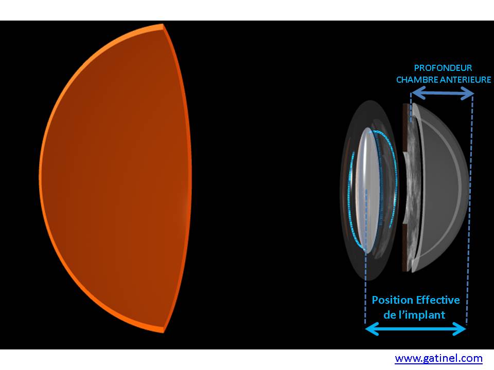 L'implantation de la « Légende » Cercle K2 - Cercle K2