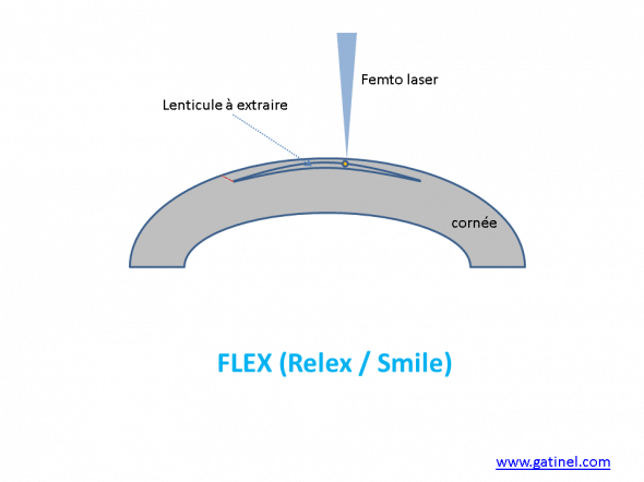 flex relex smile
