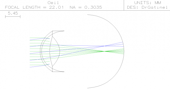 Oeil 2D myopie forte simulation par ray tracing