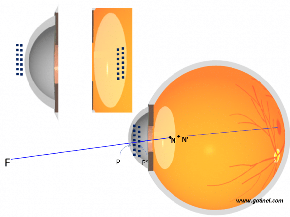 schéma des points principaux de l'oeil