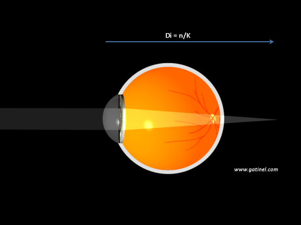 Réfraction par la cornée seule