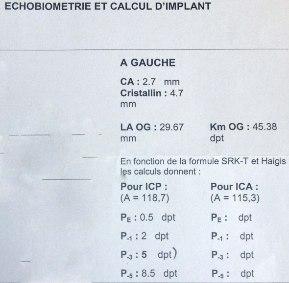 biométrie pour implant emmétropisant, forte myopie