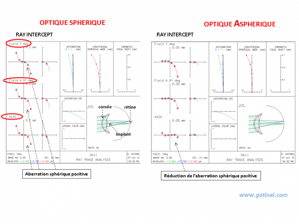 ray intercept diagramme comparant implant sphérique et asphérique