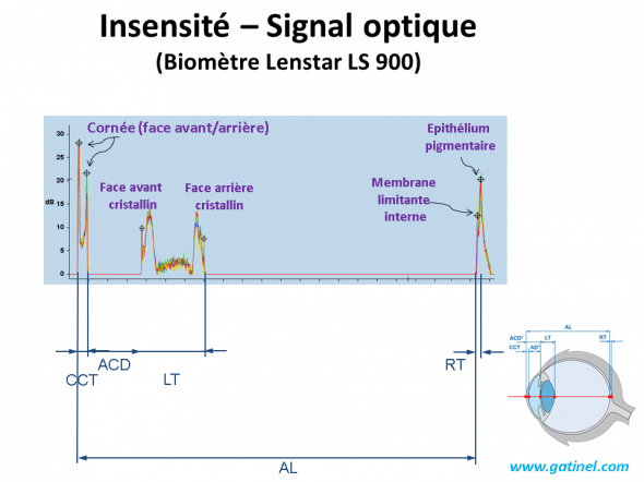  intensité du signal optique en biométrie oculaire anatomie et mesure des disances
