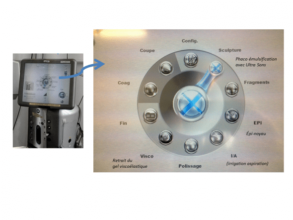 Ecran du phaco emulsificateur stellaris (bausch & lomb)