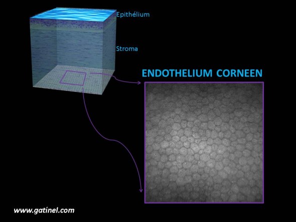 Représentation de l'endothélium cornéen