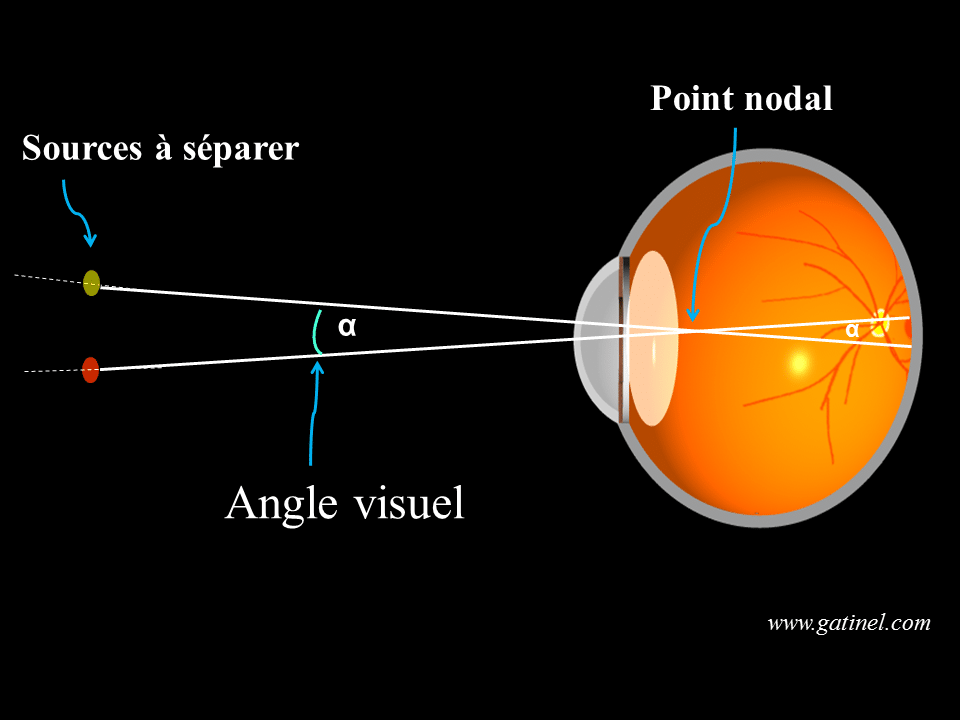 Angle visuel - Docteur Damien Gatinel