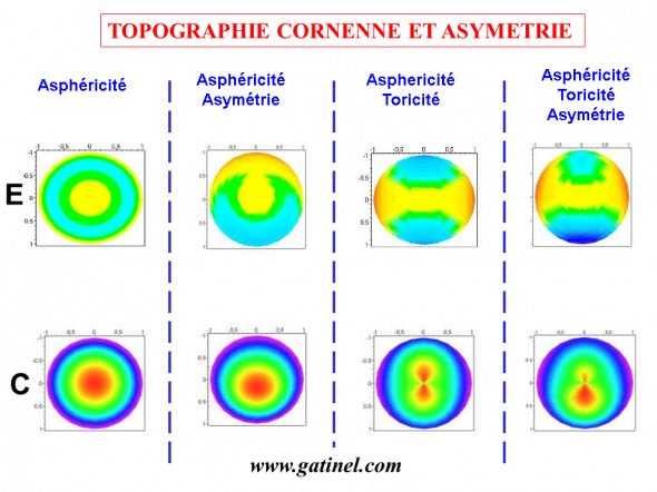 asymétries cornéeennes, toricité, asphéricité: comparaison entre les cartes de courbure élévation