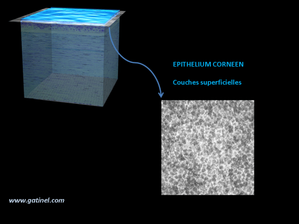 microscopie confocale de l'épithélium cornéen superficiel