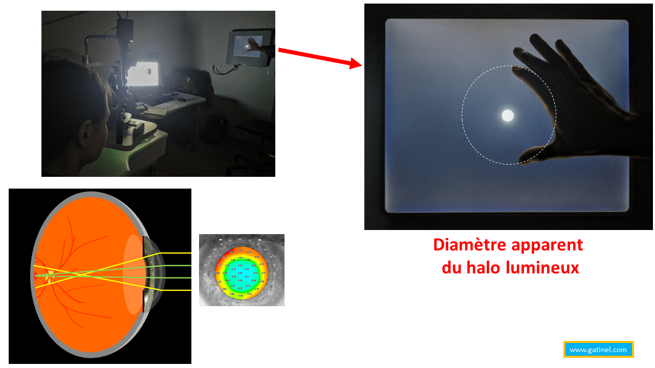 Lunettes de conduite à verres jaunes : pas utiles pour mieux voir la nuit !  - Réalités Ophtalmologiques