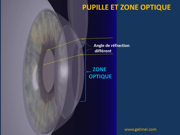 pupille zone optique schéma