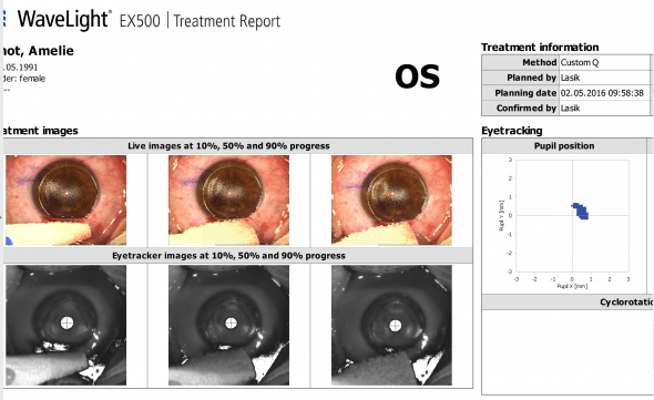 eye tracker EX500