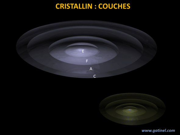 Les couches du cristallin comportent : le noyau embryonnaire (E), le noyau fœtal (F), le noyau adulte (A) et le cortex (C). Avec l’âge, le cristallin perd sa transparence, et le cortex s’épaissit (en bas à droite). 