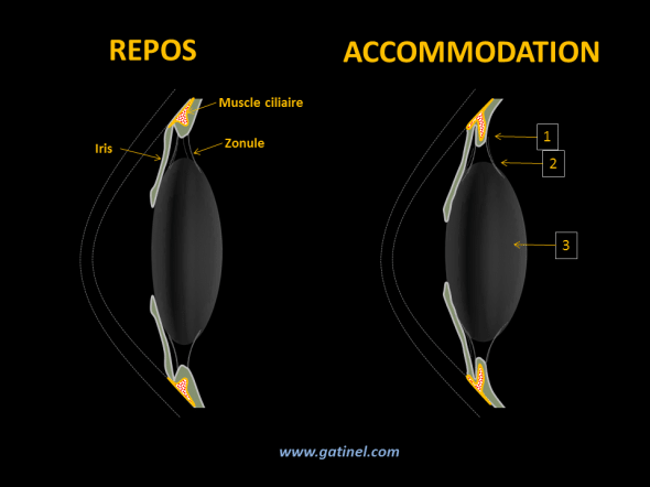 L’accommodation est effectuée grâce à une contraction du muscle ciliaire (1). La réduction de son diamètre provoque un relâchement de la zonule. Le cristallin adopte alors sa forme naturelle, qui est plus bombée. Sa face antérieure se déplace légèrement vers l’avant, la pupille se contracte (myosis). Le bombement du cristallin et la réduction du diamètre de la pupille permettent de mettre au point des objets rapprochés sur la rétine.  